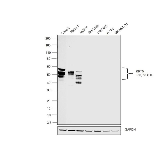 Cytokeratin 8 Antibody in Western Blot (WB)