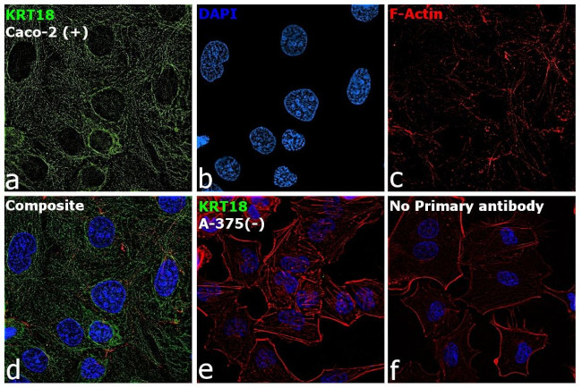 Cytokeratin 18 Antibody in Immunocytochemistry (ICC/IF)