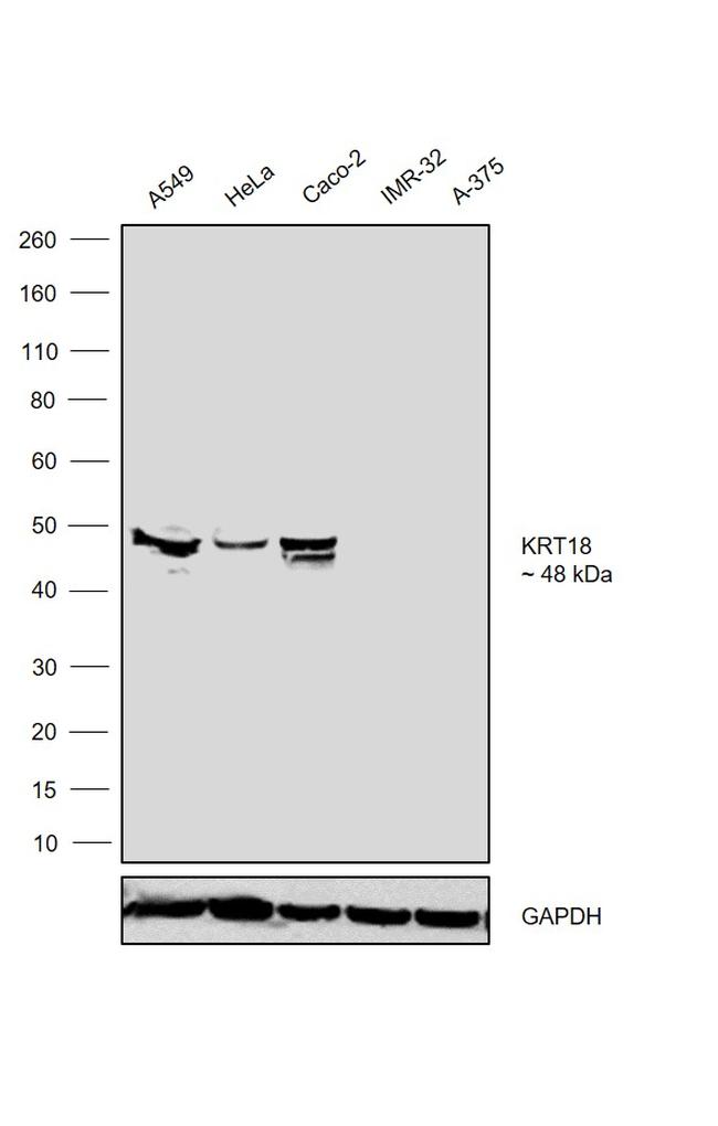 Cytokeratin 18 Antibody in Western Blot (WB)