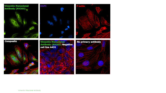 Vimentin Antibody