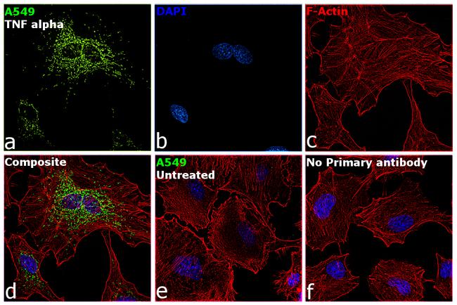 SOD2 Antibody