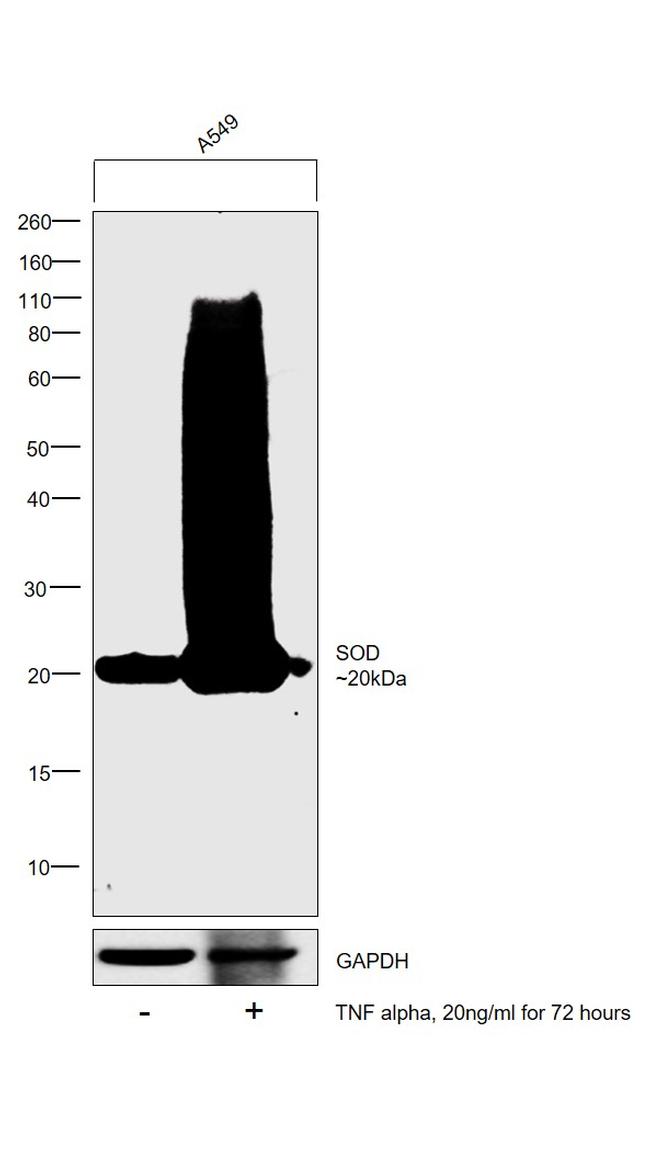 SOD2 Antibody in Western Blot (WB)