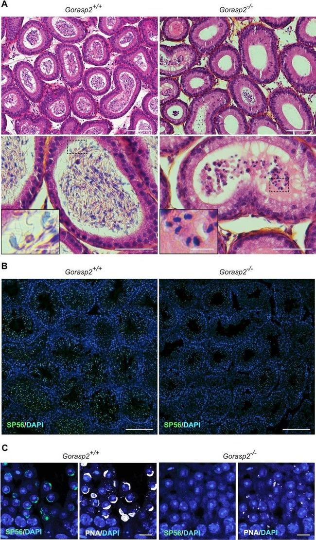 Sp56 Antibody in Immunohistochemistry (IHC)