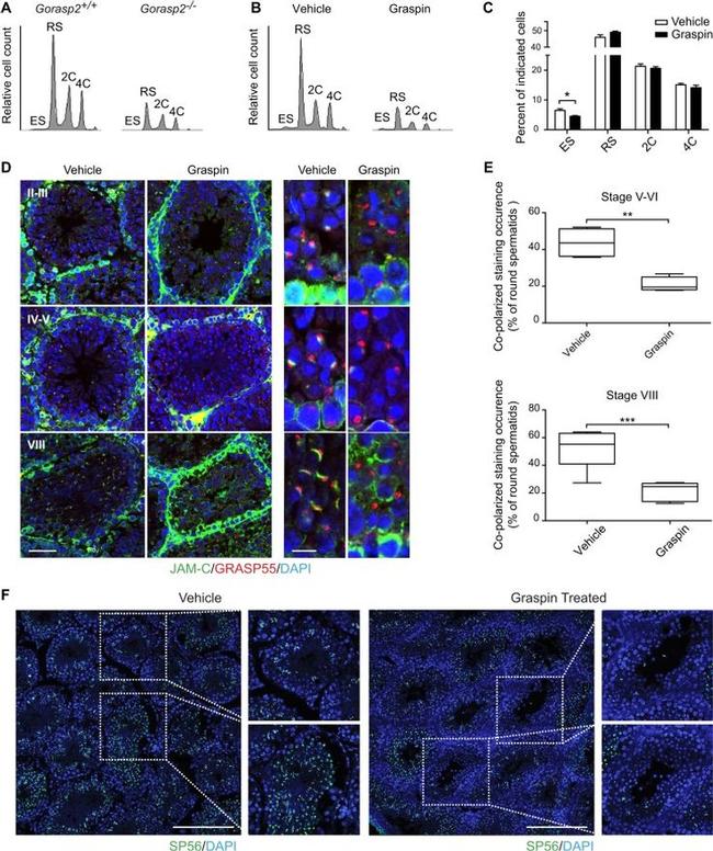 Sp56 Antibody in Immunohistochemistry (IHC)