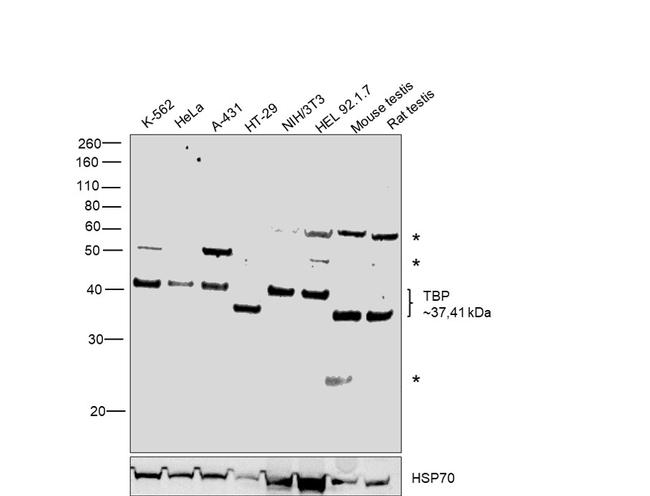 TBP Antibody in Western Blot (WB)