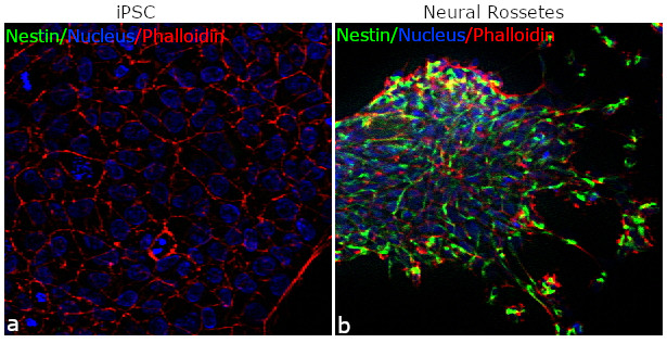 Nestin Antibody in Immunocytochemistry (ICC/IF)