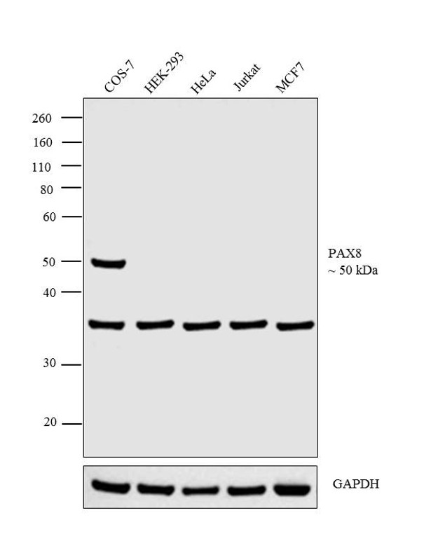PAX8 Monoclonal Antibody (1F8-3A8)