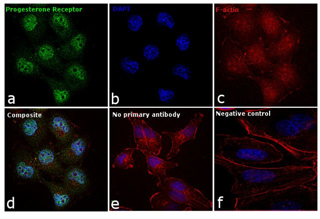 Progesterone Receptor Antibody in Immunocytochemistry (ICC/IF)