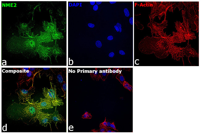 NME2 Antibody in Immunocytochemistry (ICC/IF)