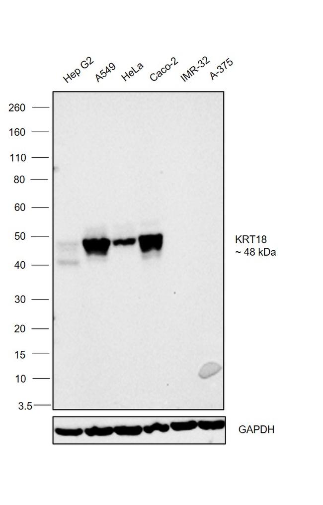 Cytokeratin 18 Monoclonal Antibody (DC-10)