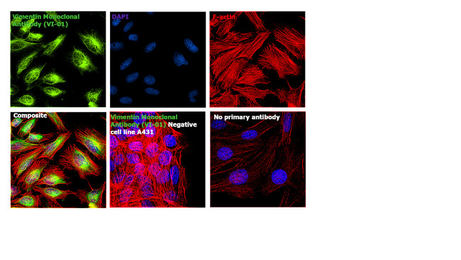 Vimentin Antibody