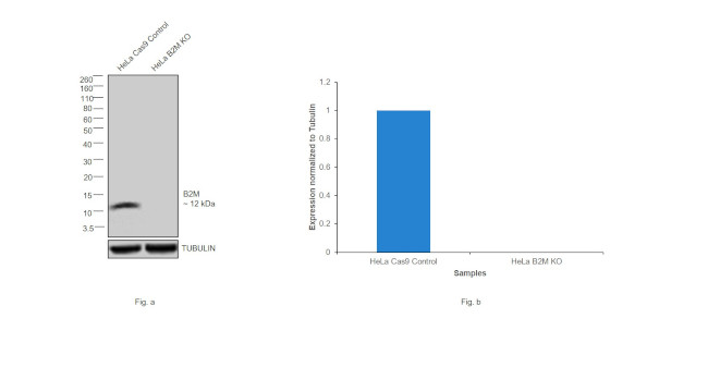 beta-2 Microglobulin Antibody