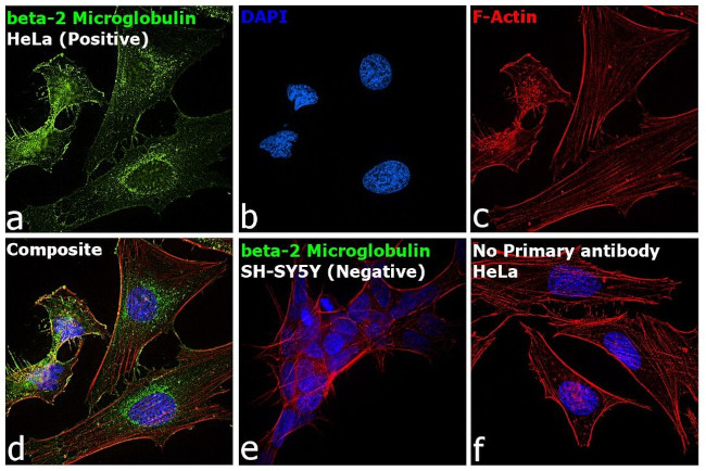 beta-2 Microglobulin Antibody in Immunocytochemistry (ICC/IF)