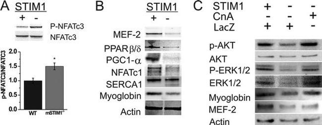 NFATC1 Antibody in Western Blot (WB)