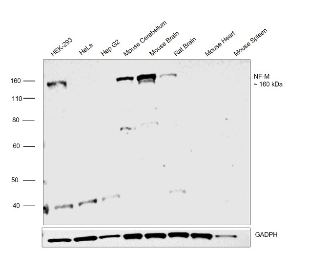 NEFM Antibody