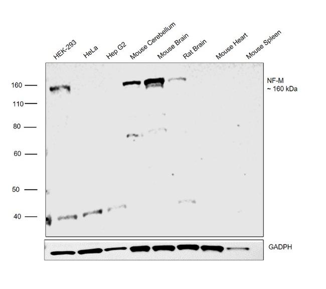 NEFM Antibody in Western Blot (WB)