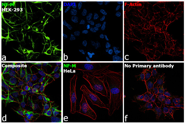 NEFM Antibody