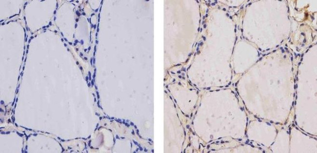 THRA/THRB Antibody in Immunohistochemistry (Paraffin) (IHC (P))