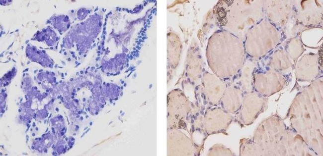 THRA/THRB Antibody in Immunohistochemistry (Paraffin) (IHC (P))