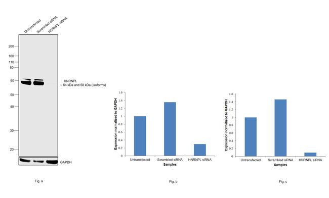 hnRNP L Antibody in Western Blot (WB)