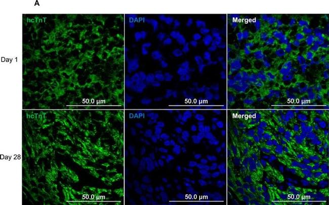 Cardiac Troponin T Antibody in Immunohistochemistry (IHC)