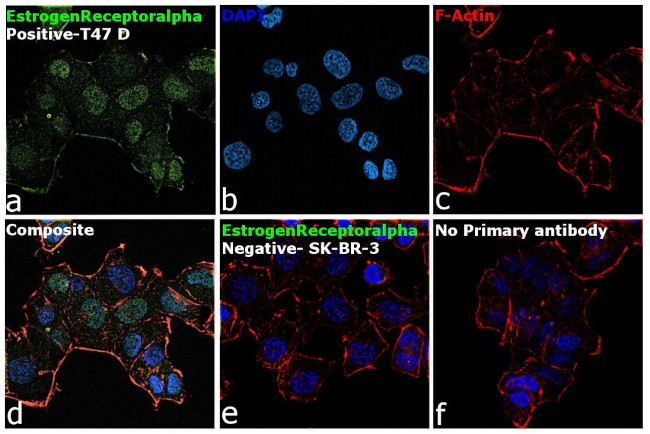 Estrogen Receptor alpha Antibody