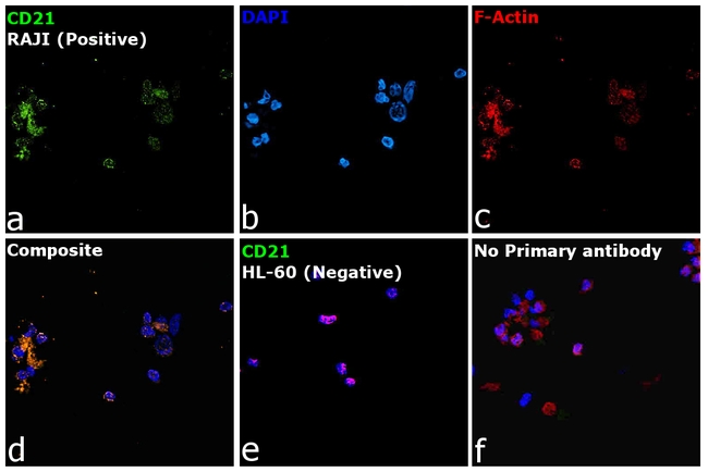 CD21 Antibody in Immunocytochemistry (ICC/IF)