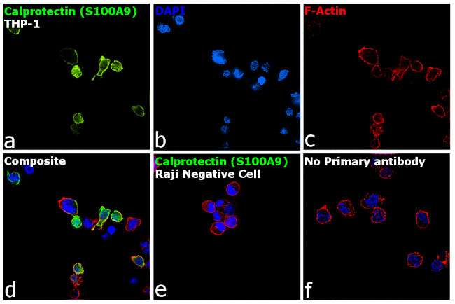 Calprotectin Antibody