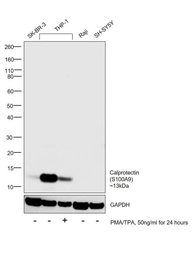 Calprotectin Antibody