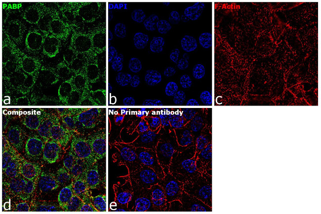 PABP Antibody in Immunocytochemistry (ICC/IF)