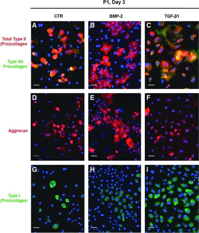 Collagen II Antibody in Immunocytochemistry (ICC/IF)