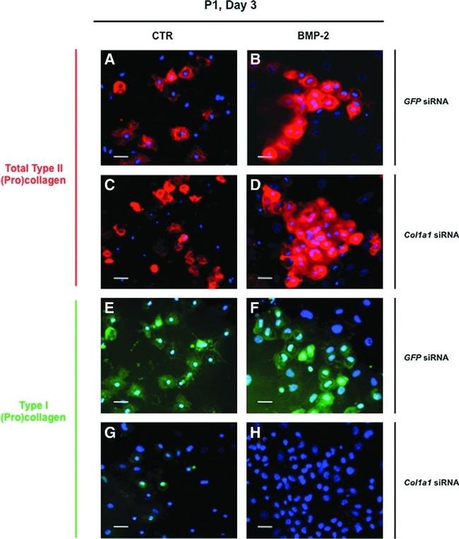 Collagen II Antibody in Immunocytochemistry (ICC/IF)