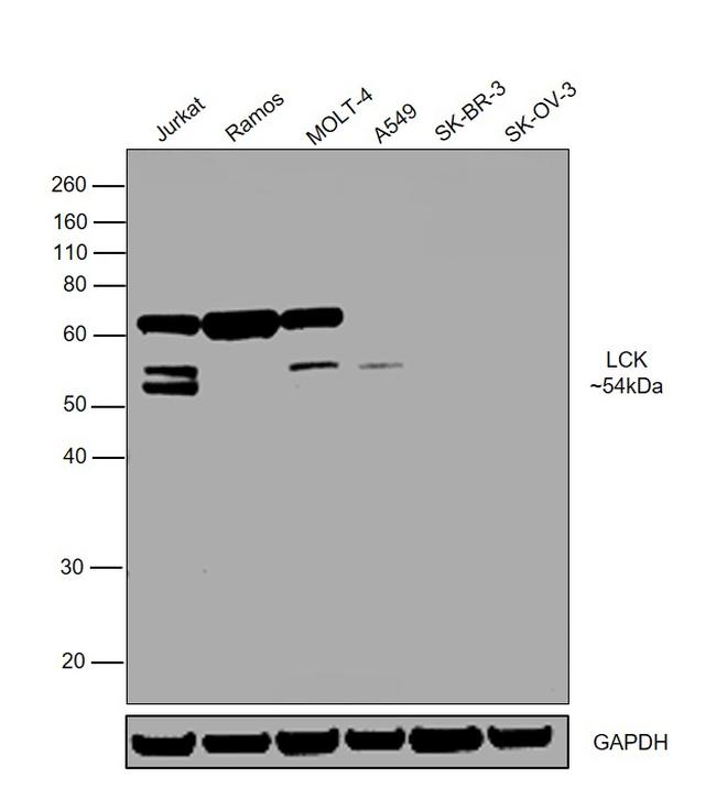 LCK Antibody in Western Blot (WB)