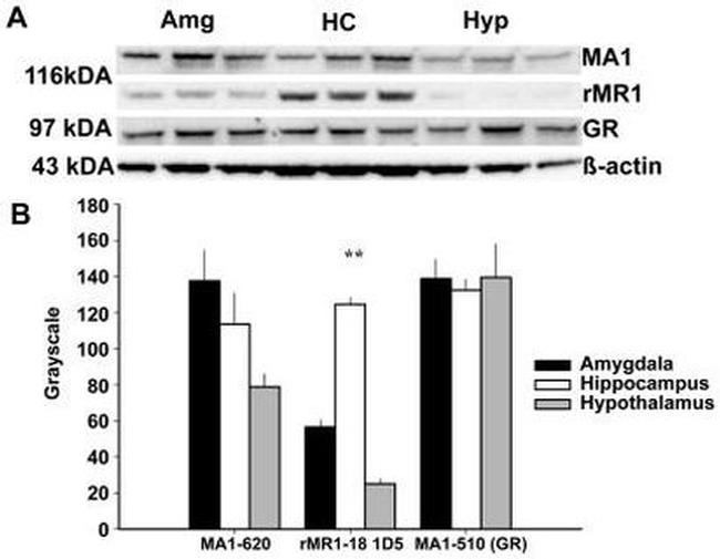 Glucocorticoid Receptor Antibody in Western Blot (WB)