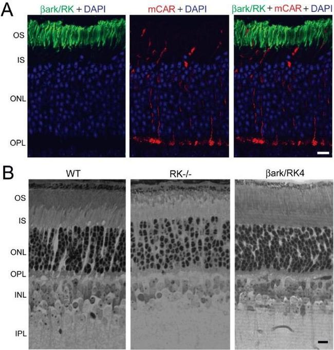 GRK1 Antibody in Immunohistochemistry (IHC)