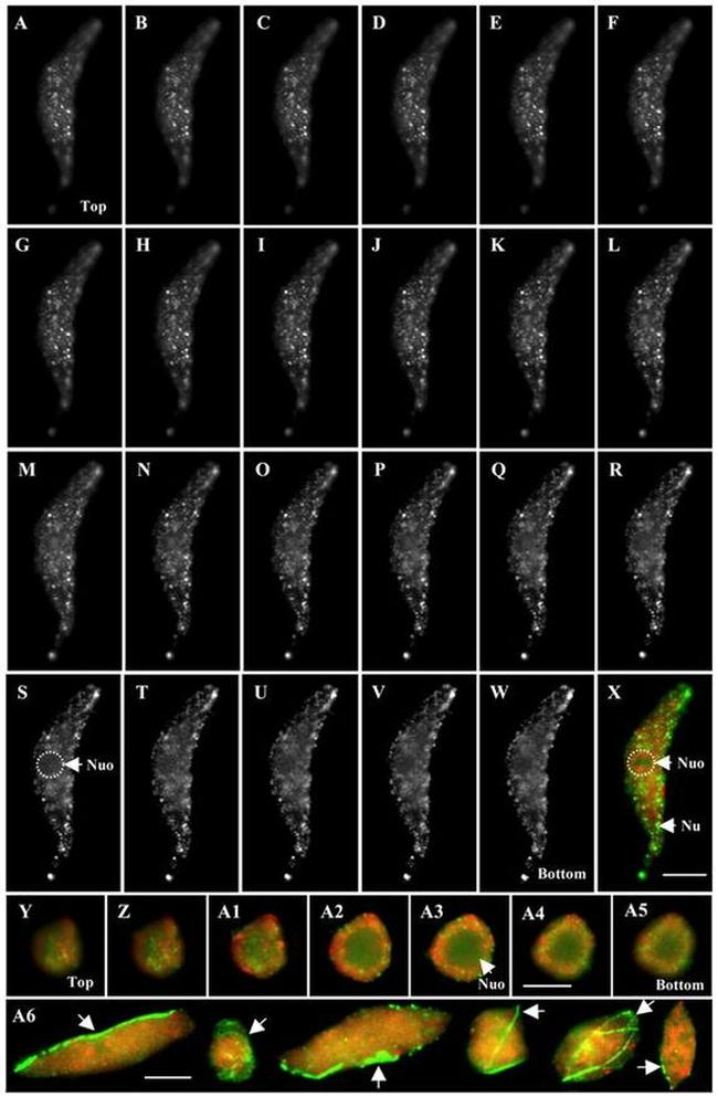 Actin Antibody in Immunocytochemistry (ICC/IF)