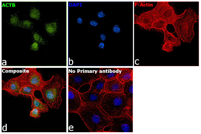 Actin Antibody in Immunocytochemistry (ICC/IF)