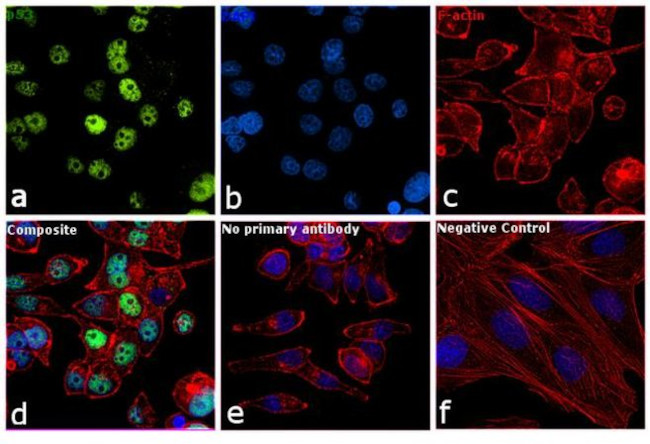 p53 Antibody in Immunocytochemistry (ICC/IF)