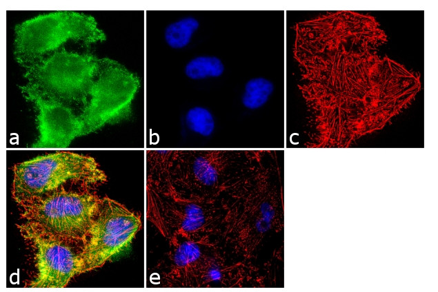 TIMP2 Antibody in Immunocytochemistry (ICC/IF)