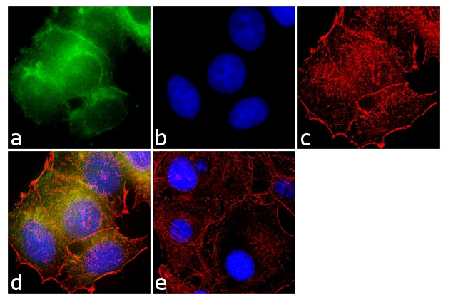 RARB Antibody in Immunocytochemistry (ICC/IF)