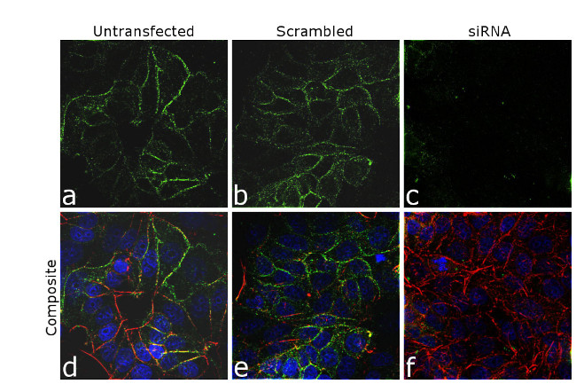 IGF1R alpha Antibody in Immunocytochemistry (ICC/IF)