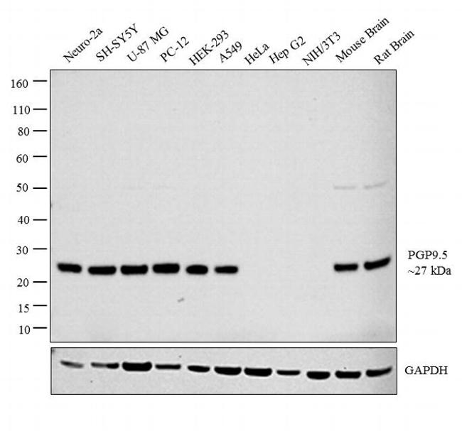 PGP9.5 Monoclonal Antibody (31A3) (MA1-83428)
