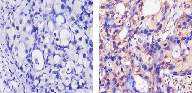 ErbB4 Antibody in Immunohistochemistry (Paraffin) (IHC (P))