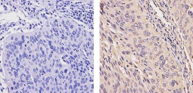 ErbB4 Antibody in Immunohistochemistry (Paraffin) (IHC (P))