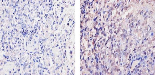 ErbB4 Antibody in Immunohistochemistry (Paraffin) (IHC (P))