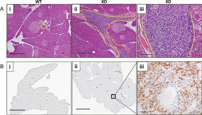 CD3e Antibody in Immunohistochemistry (Paraffin) (IHC (P))