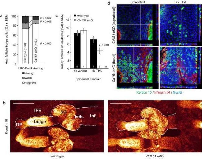 Cytokeratin 15 Antibody in Immunohistochemistry (IHC)