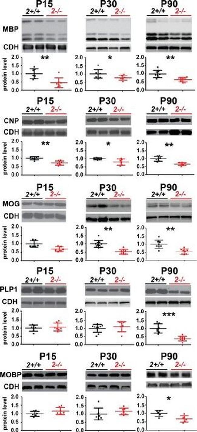 N-cadherin Antibody in Western Blot (WB)