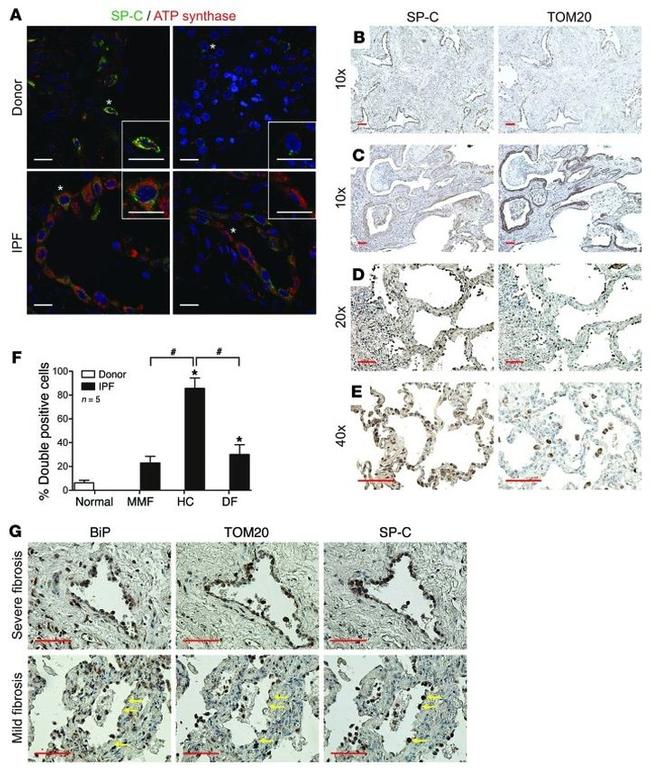 ATP Synthase beta Antibody in Immunohistochemistry (IHC)