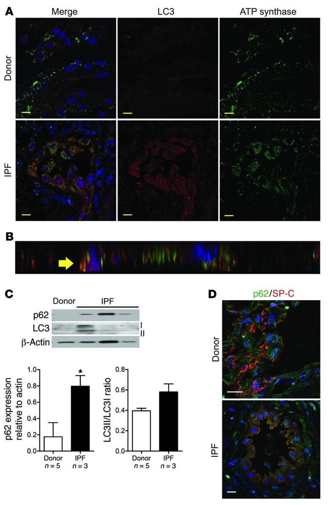 ATP Synthase beta Antibody in Immunohistochemistry (IHC)